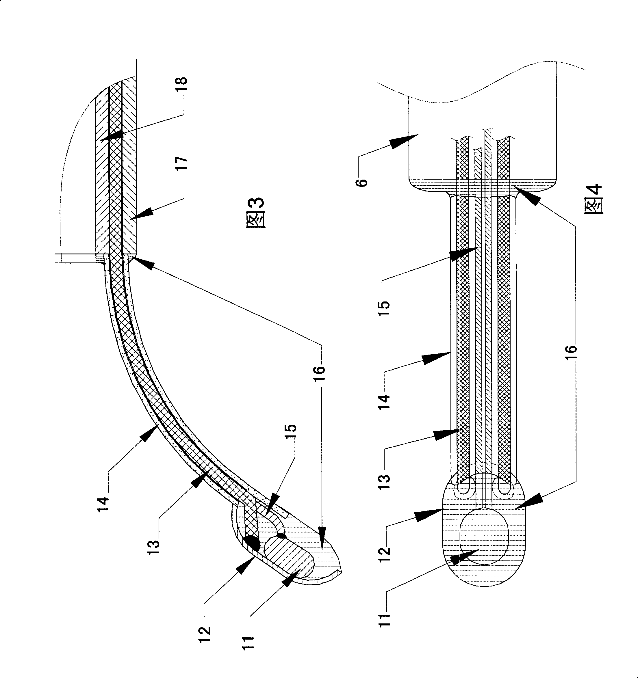 Cardiac intervention ablation catheter