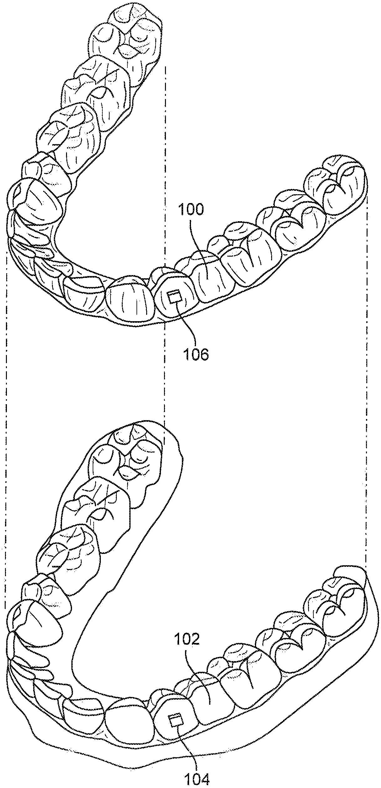 Fabrication of attachment templates and multi-material aligners