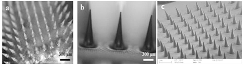 A microneedle transdermal drug delivery patch for treating rheumatoid arthritis and its preparation method