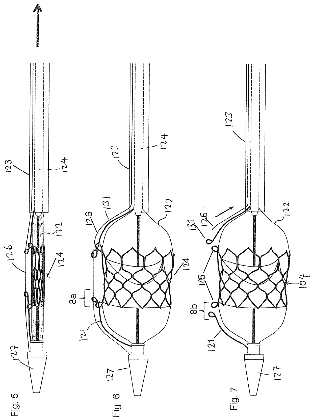 Method and Assembly for Securing an Implantable Medical Device on a Delivery System