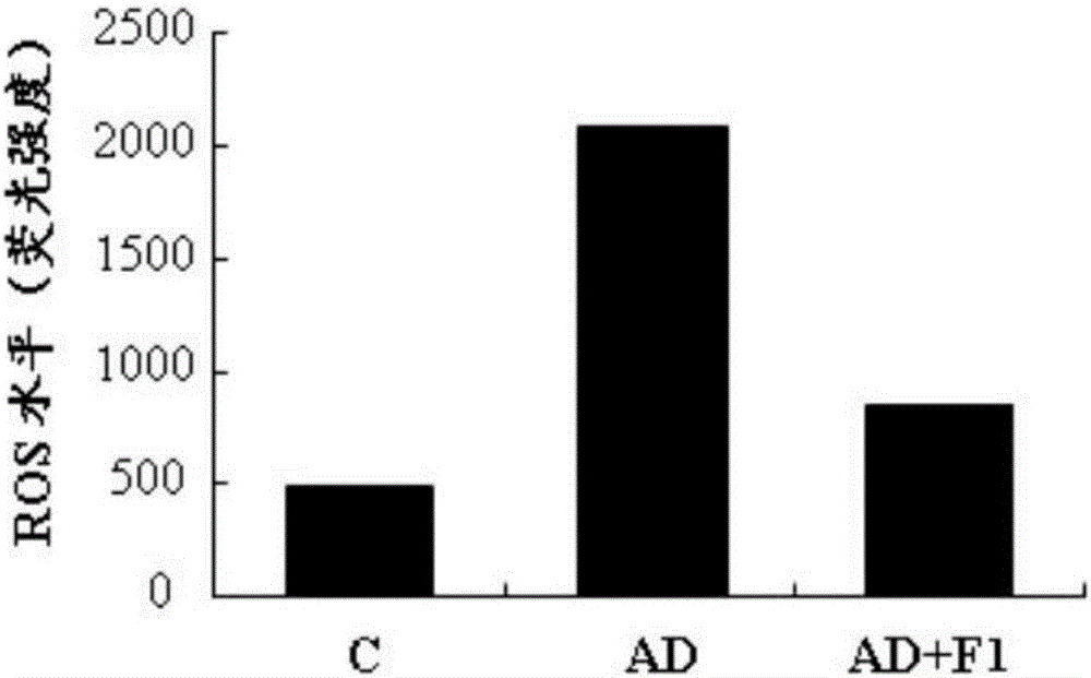 Composition for preventing or treating Alzheimer's disease