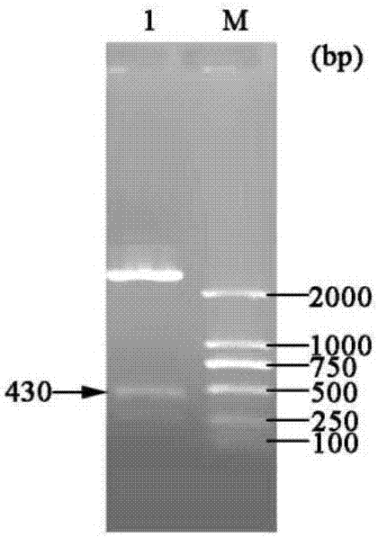 Three-gene co-expression vector for synthesizing tetrahydropyrimidine and application of co-expression vector