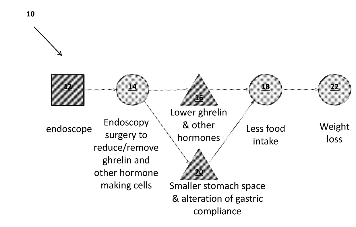 Endoscopic gastric mucosal ablation/resection/exclusion (a/r/e) as a minimally invasive weight loss approach