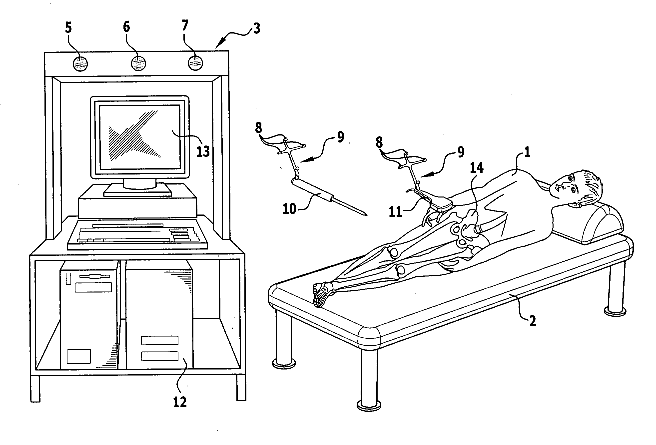 Method and apparatus for determining the frontal plane of the pelvic bone