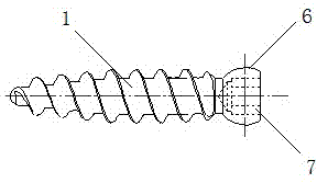 Lower tibiofibular joint hinged flexible fixator