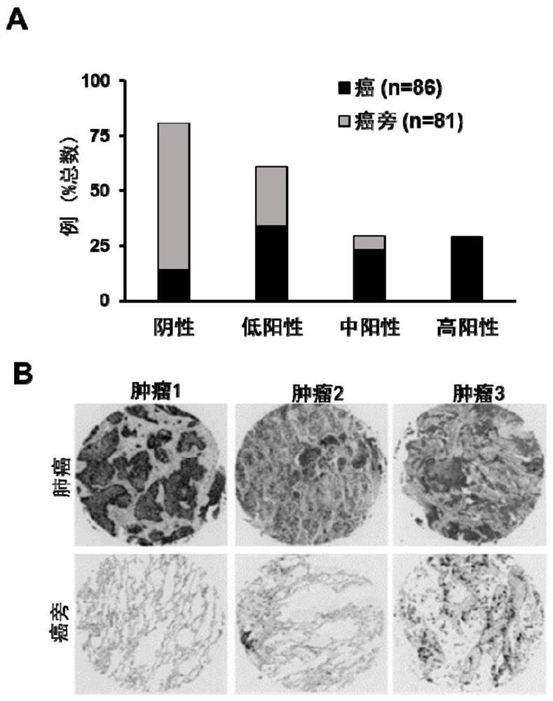 Application of CD73 ADC