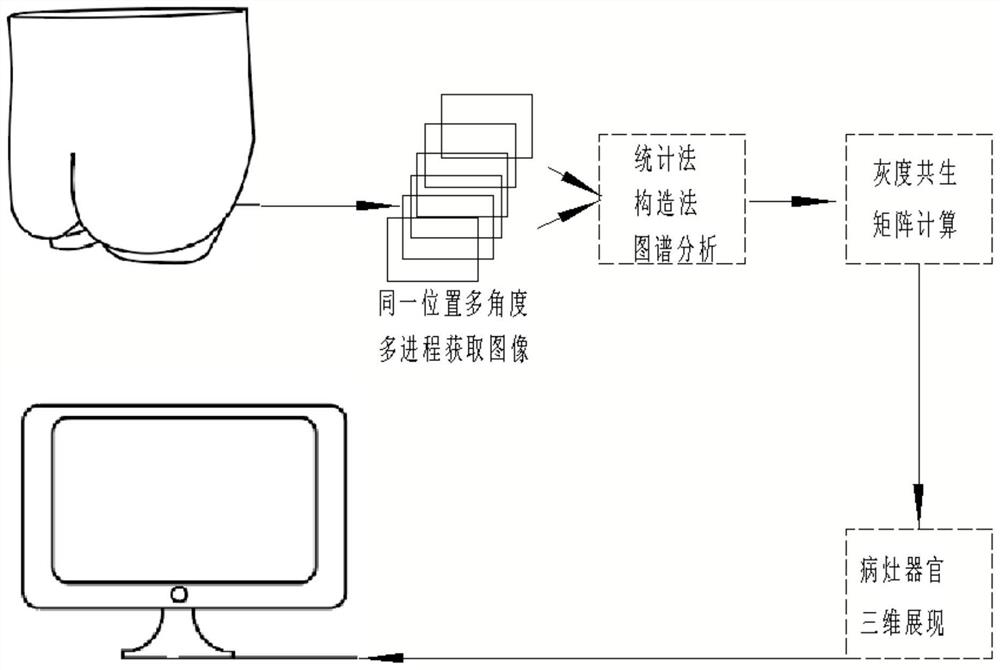 Medical picture fusion imaging colposcopy training system and picture reconstruction method