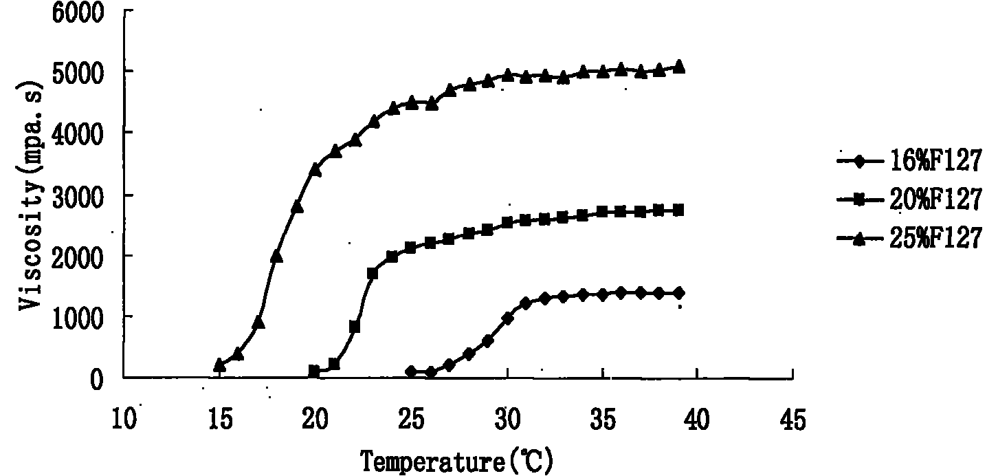 Preparation and application of olopatadine in-situ gel