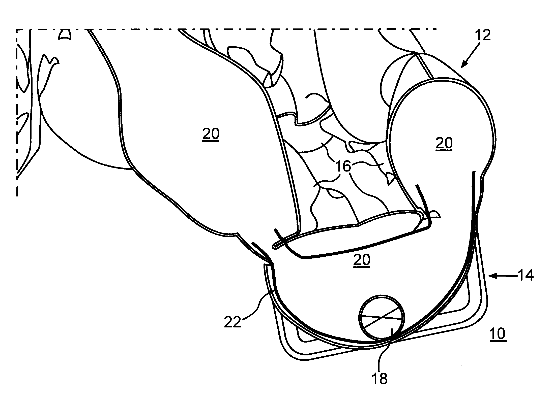 Restraint device, in particular for a motor vehicle