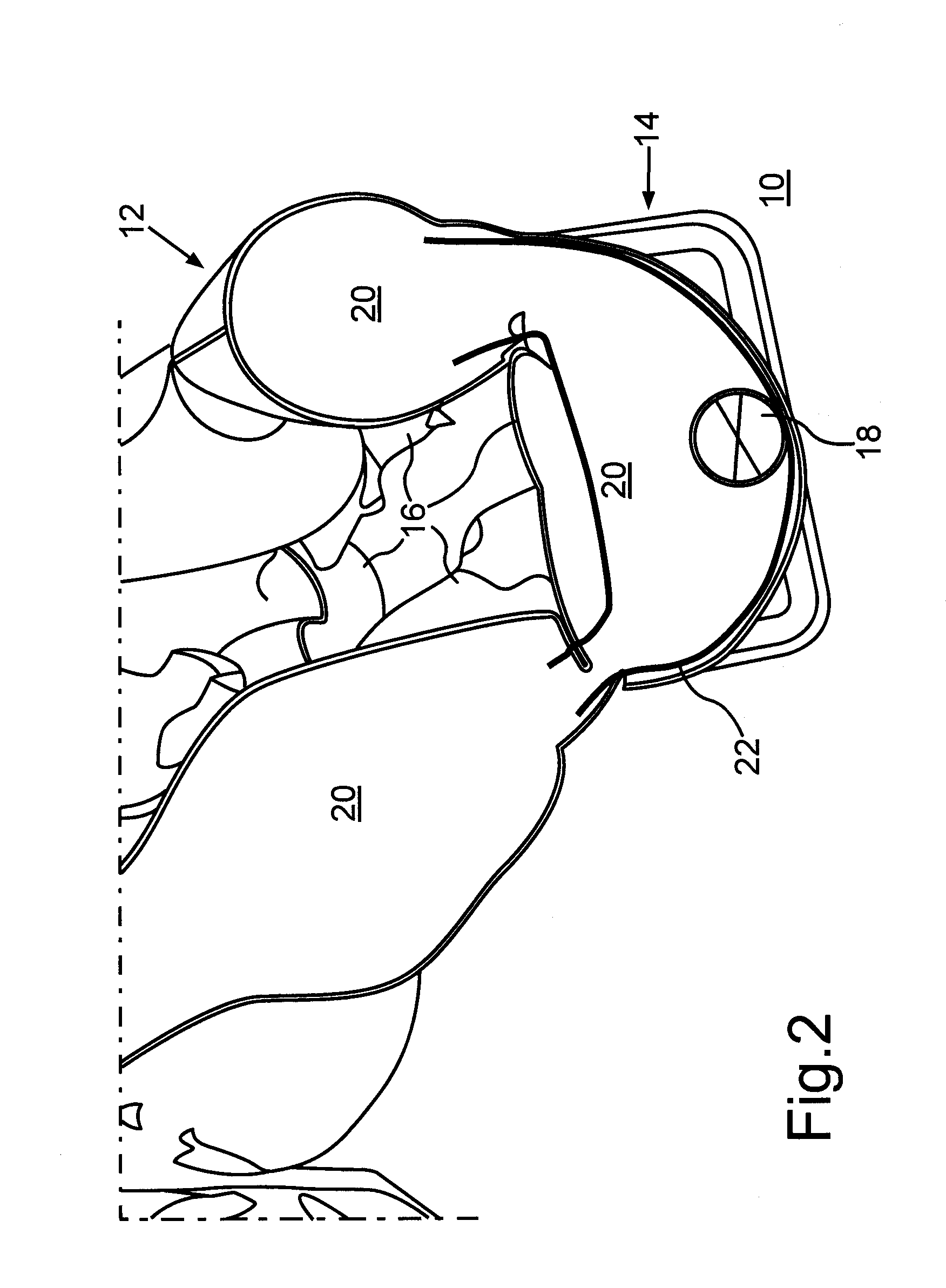 Restraint device, in particular for a motor vehicle