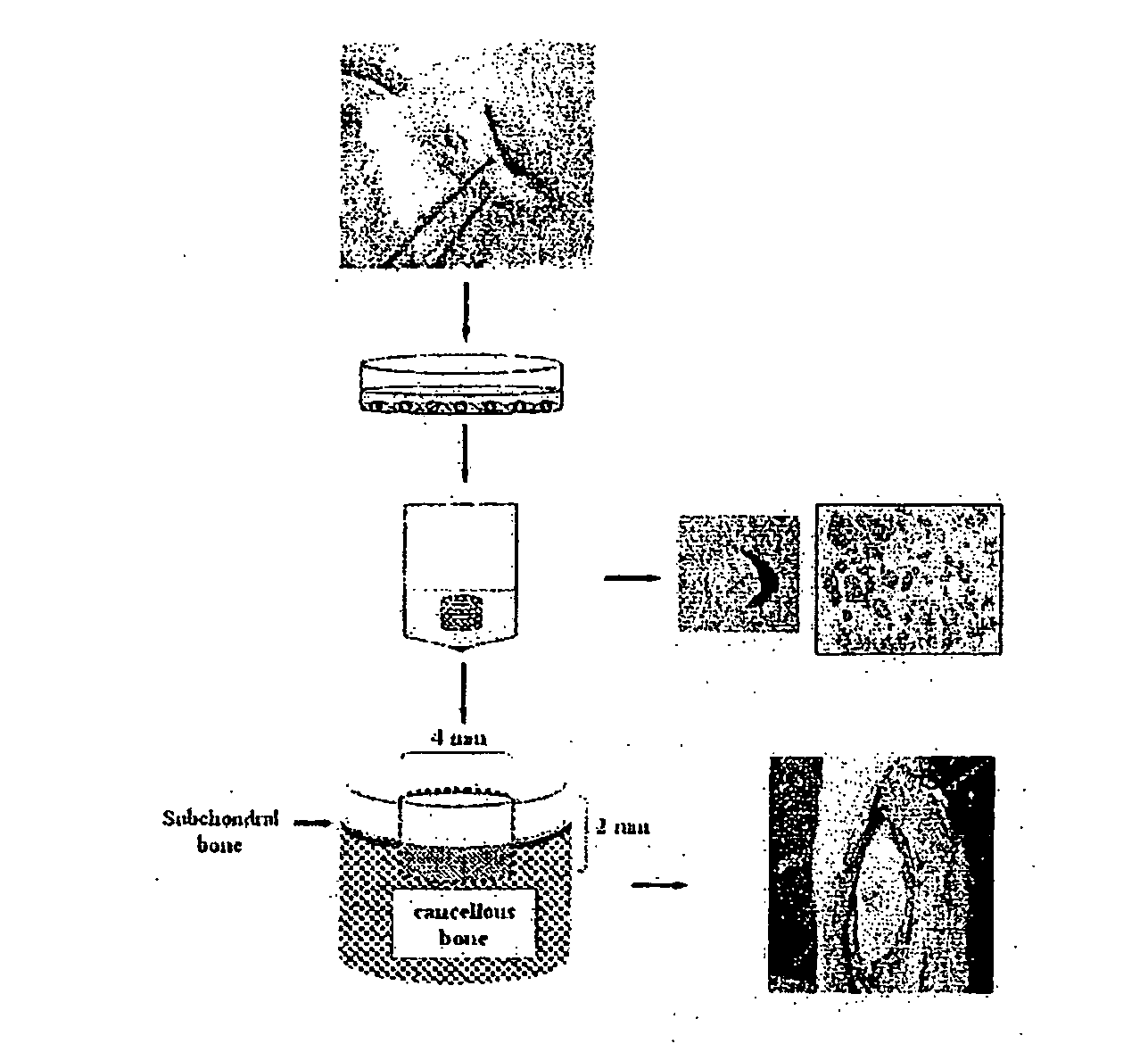 Artificial cartilage containing chondrocytes obtained from costal cartilage and preparation process thereof