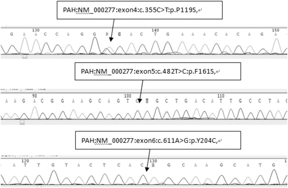 Detection kit of gene mutations associated with phenylketonuria