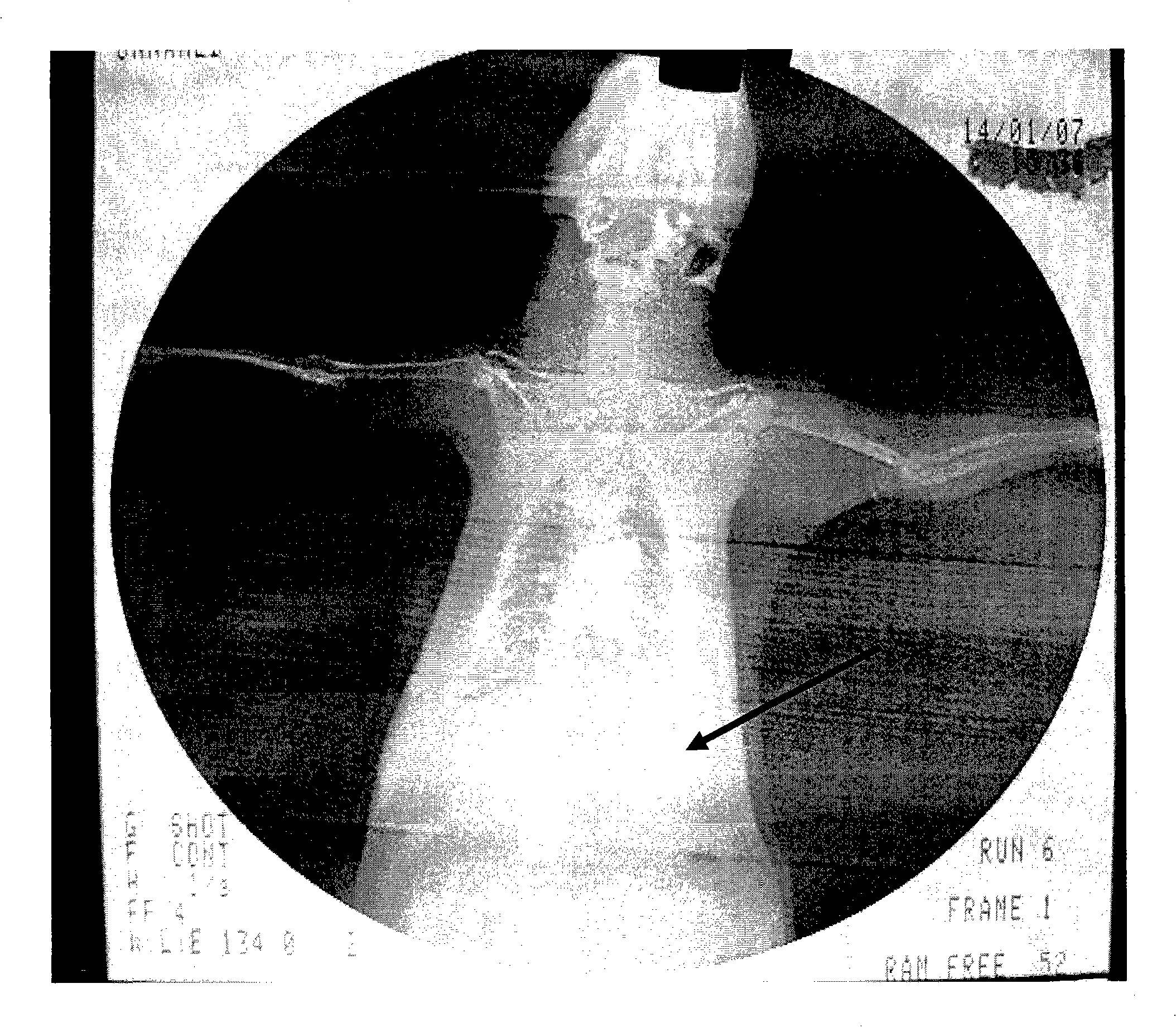 Construction method of body surface fistula rat animal model