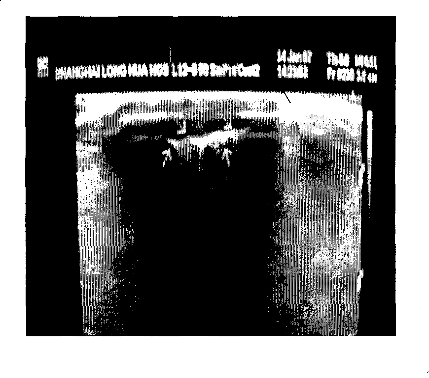 Construction method of body surface fistula rat animal model