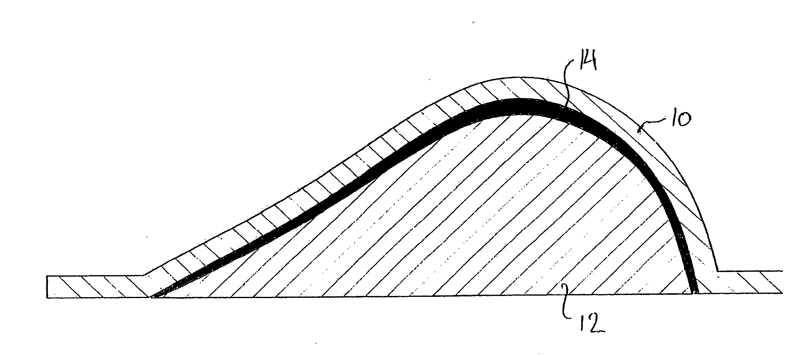 Method of manufacturing a breast prosthesis