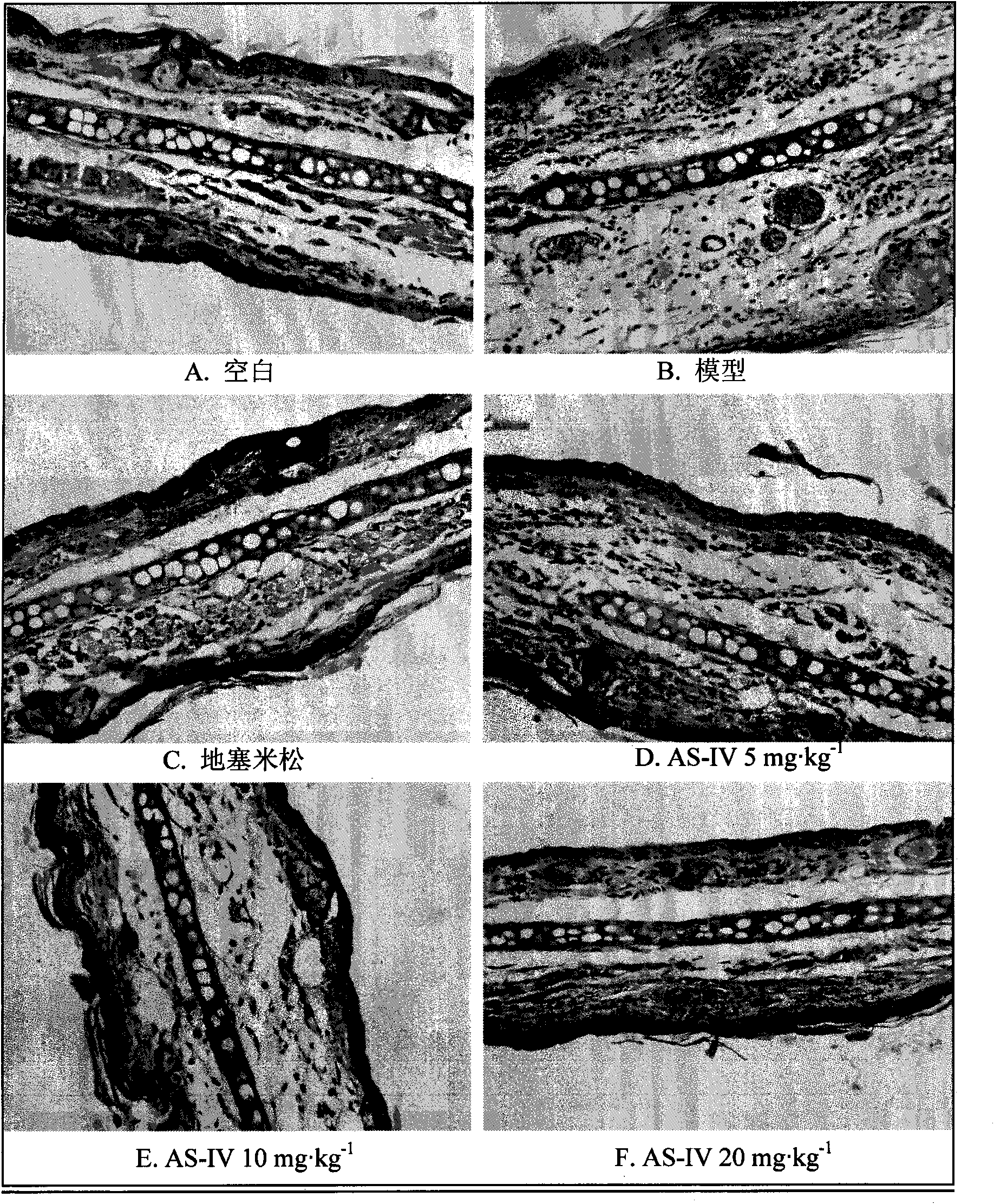 Application of astragaloside in treating delayed type hypersensitivity mediated diseases