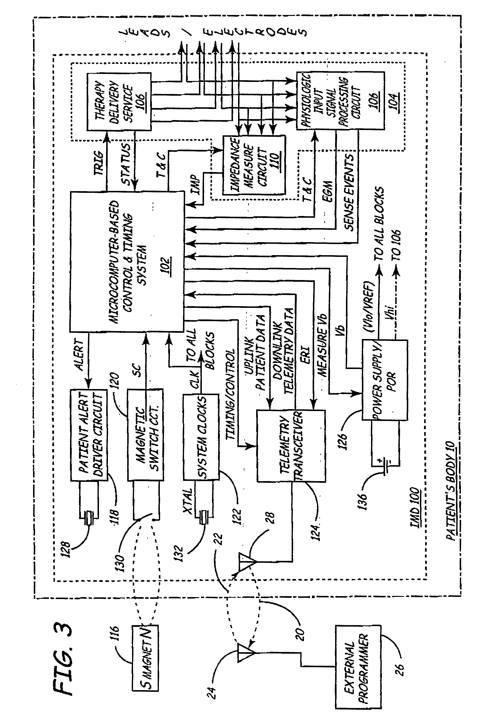 System and method for determining remaining battery life for an implantable medical device