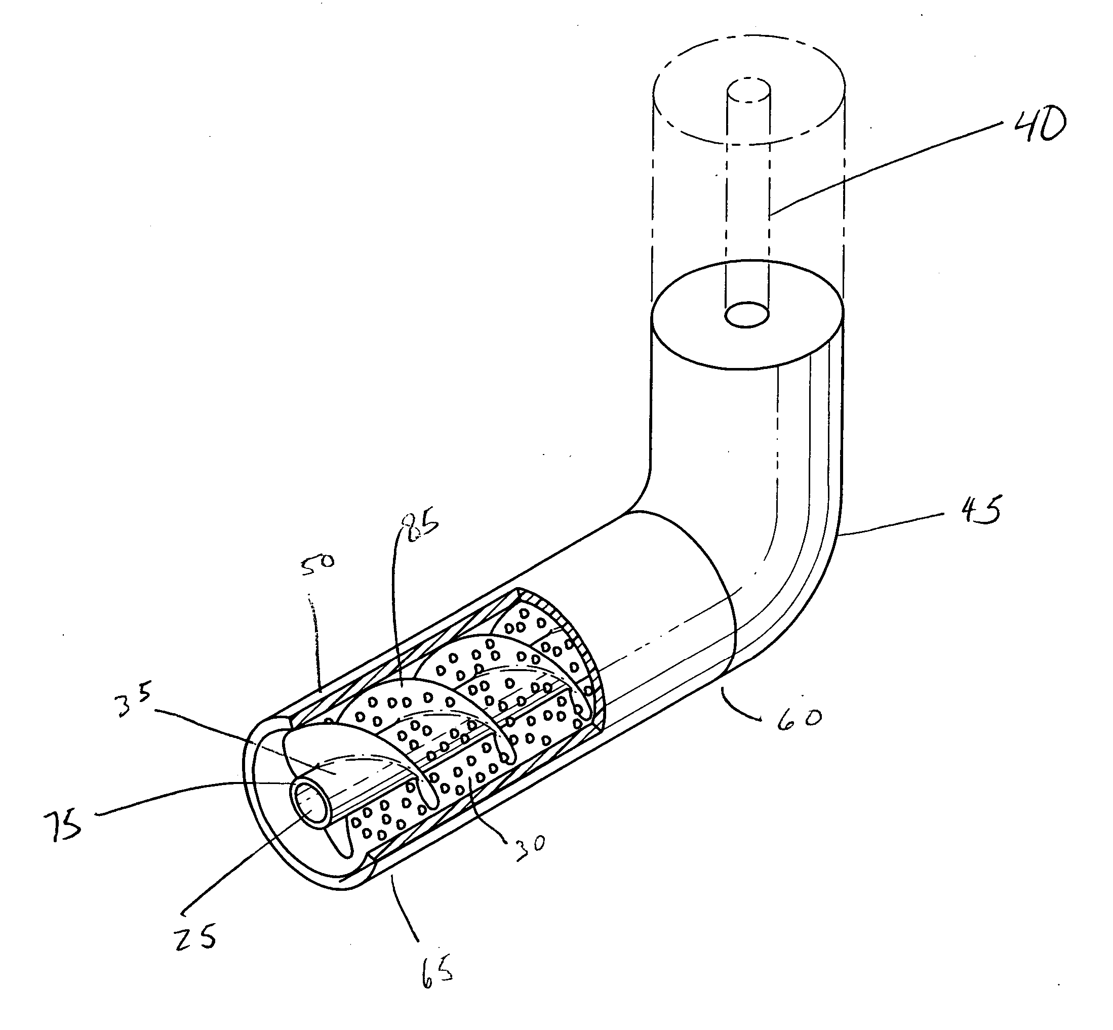 Implantable intravascular delivery device