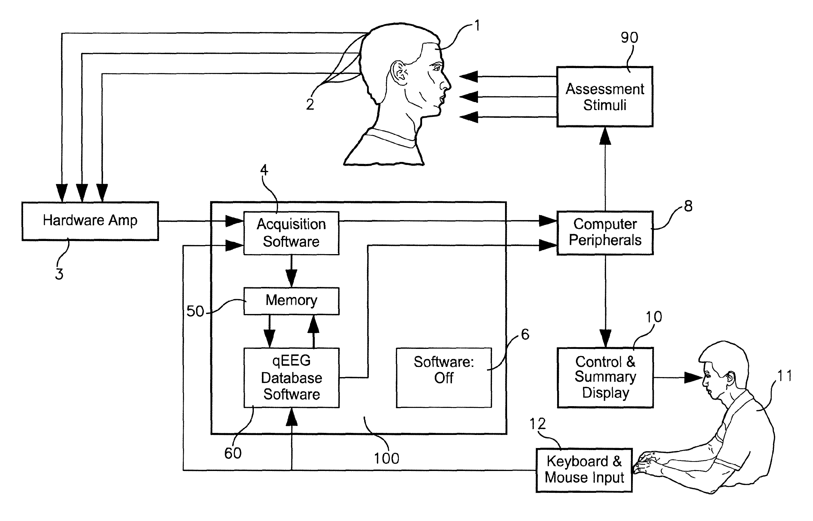 System and method for analyzing electroencephalography data