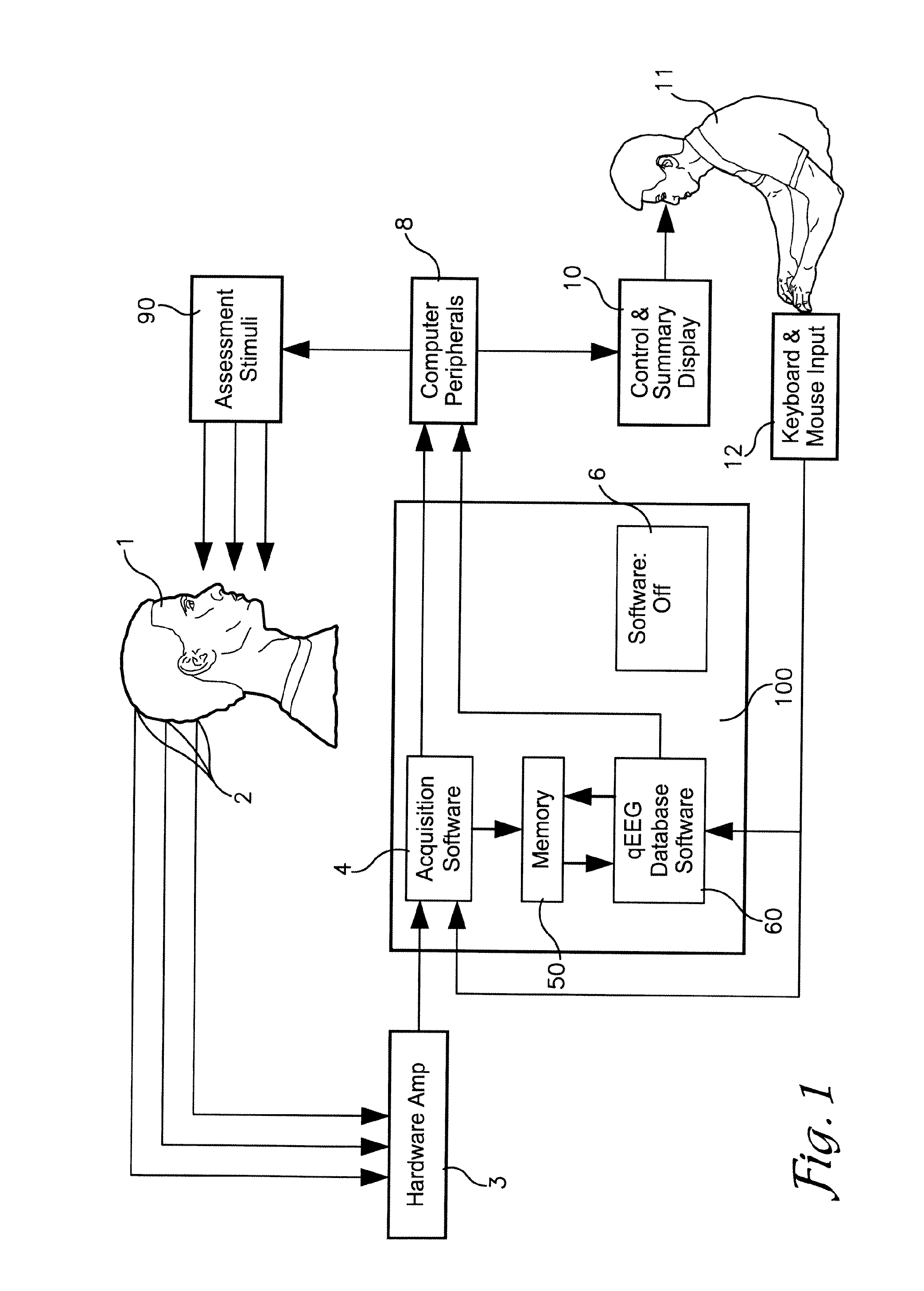 System and method for analyzing electroencephalography data