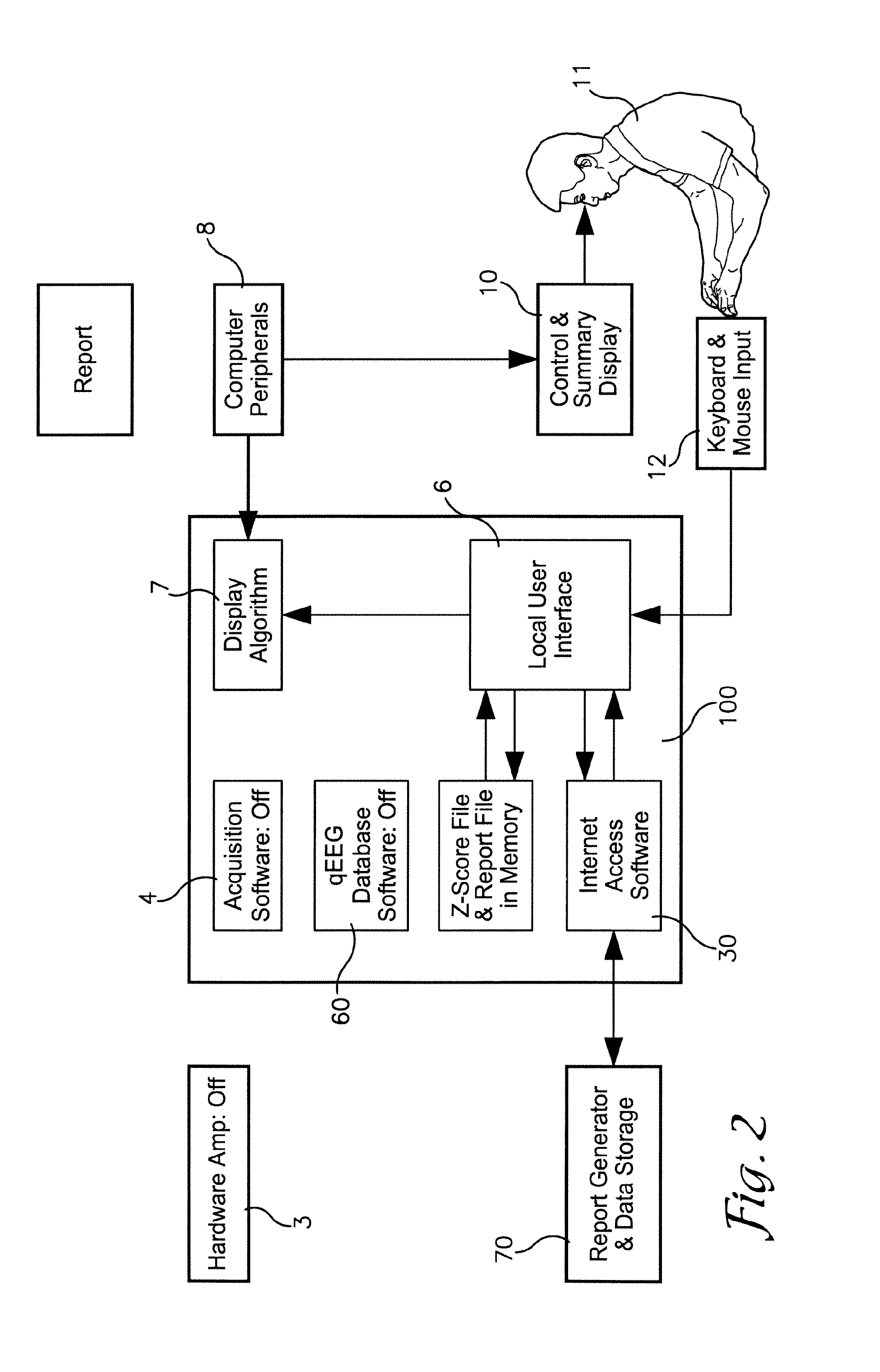 System and method for analyzing electroencephalography data