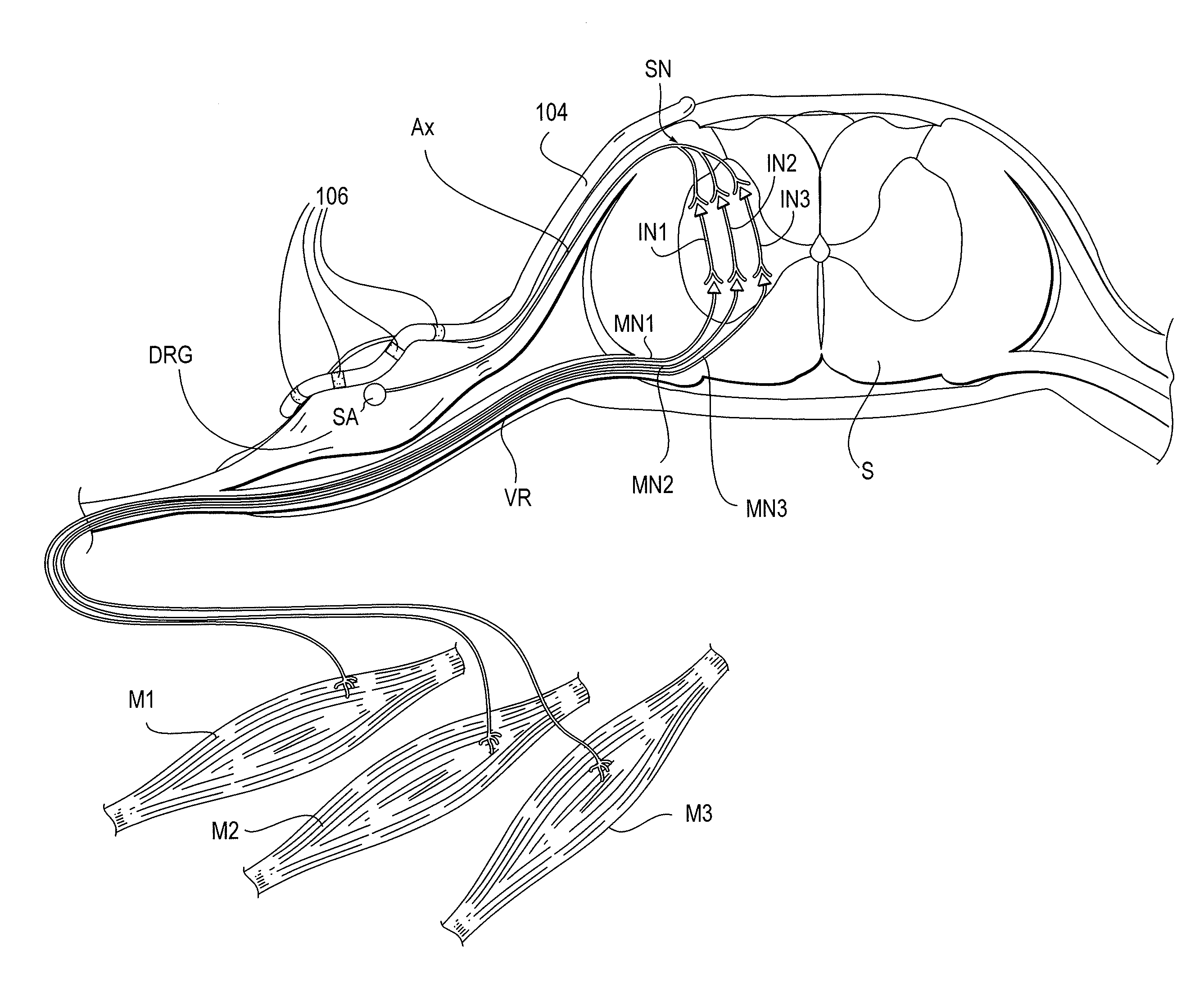 Devices, systems and methods for the targeted treatment of movement disorders