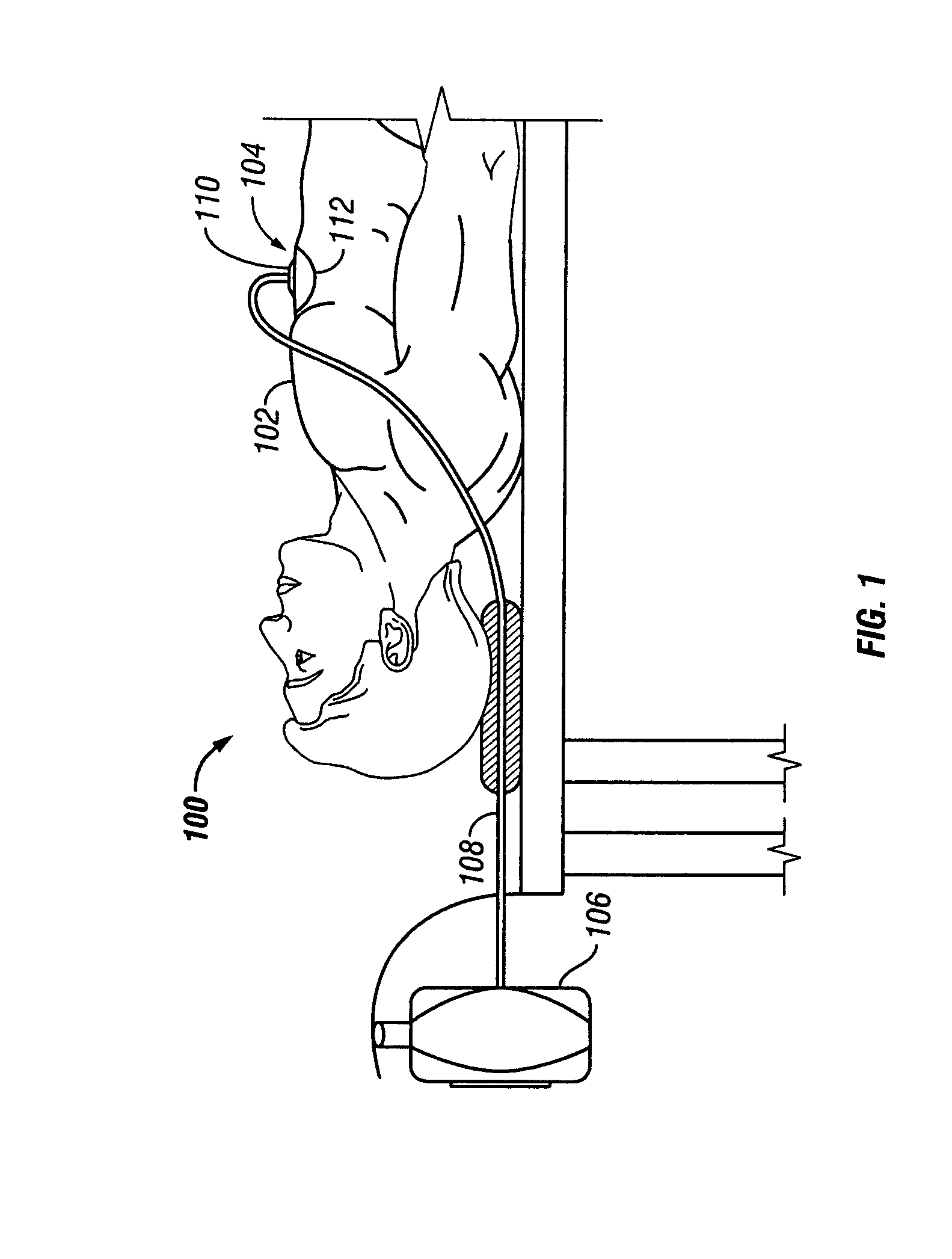 System and method for locating fluid leaks at a drape of a reduced pressure delivery system