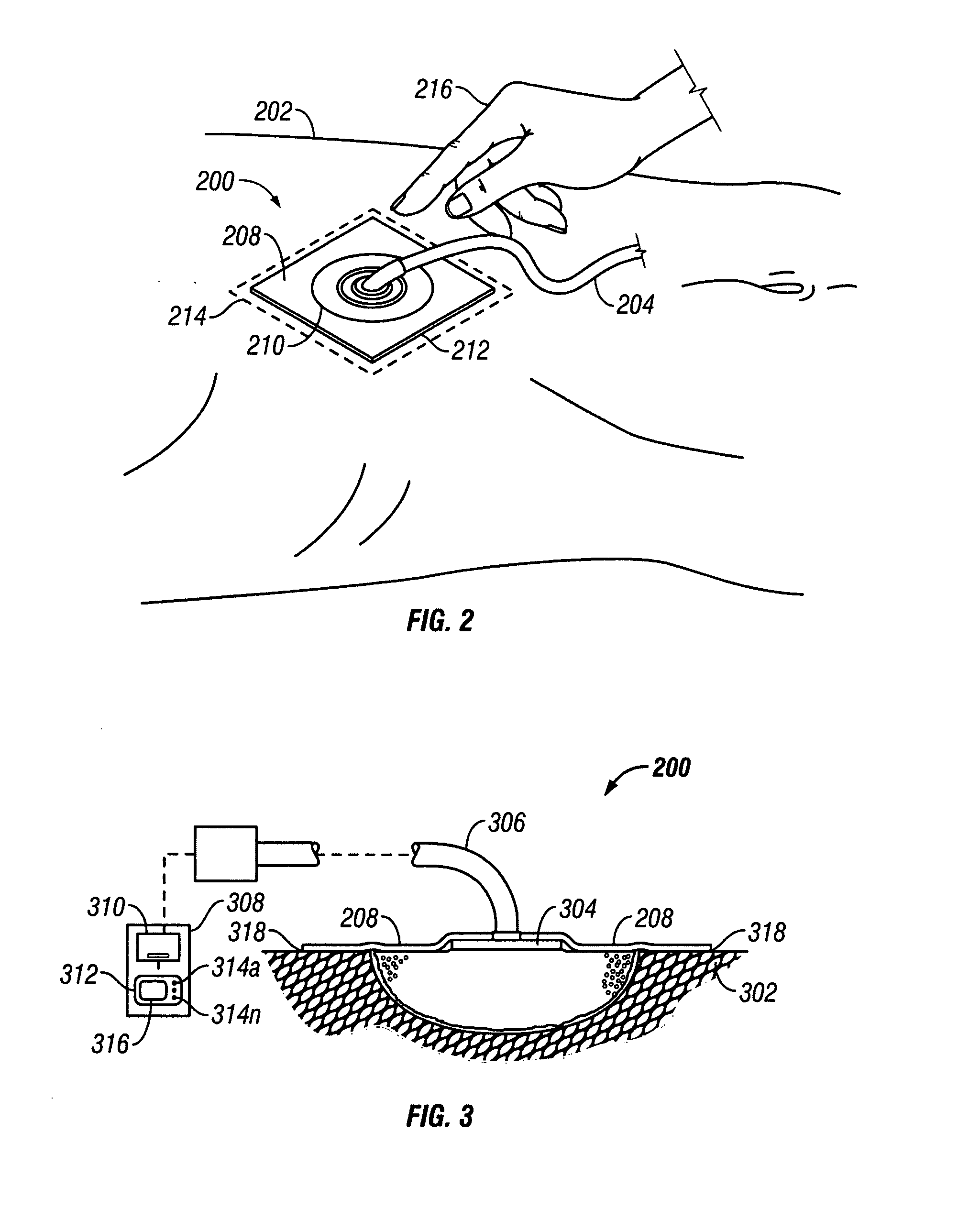 System and method for locating fluid leaks at a drape of a reduced pressure delivery system