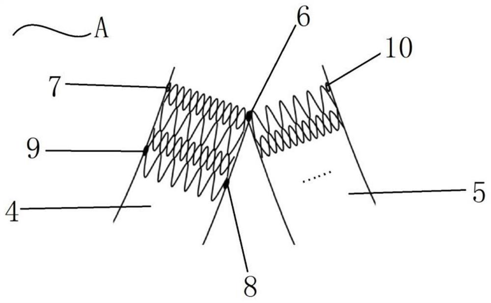 Split iliac vein stent and placement method thereof