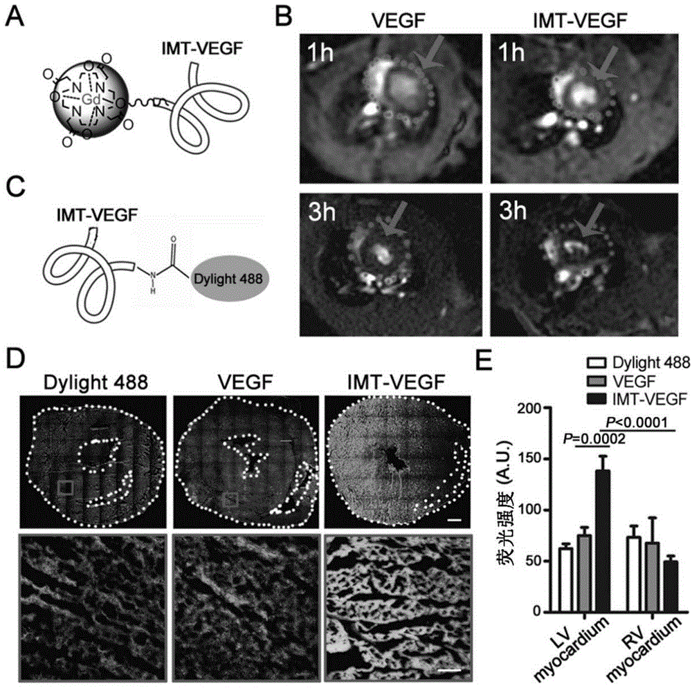 Ischemic-myocardium-targeted VEGF (vascular endothelial growth factor) recombinant protein