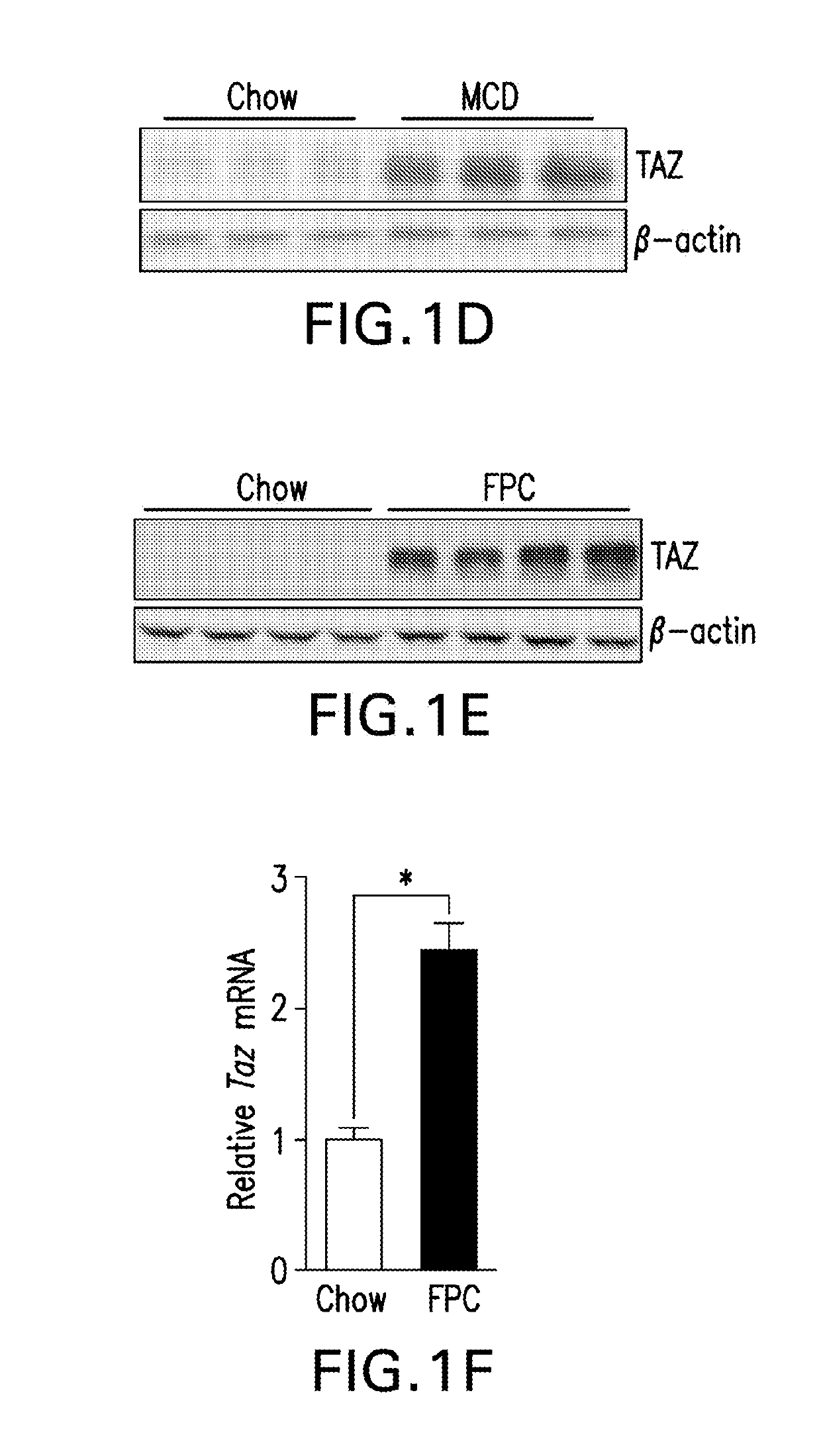 Therapeutic targets involved in the progression of nonalcoholic steatohepatitis (NASH)