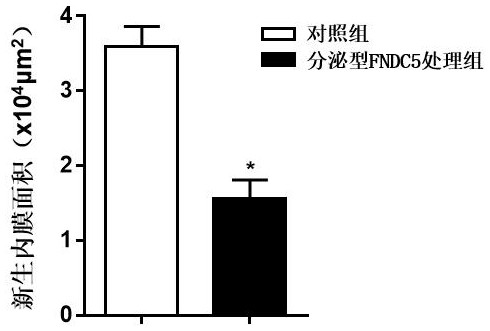 Human secretory FNDC5 protein as well as preparation method and application thereof