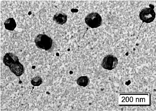 Preparation method and application of endothelial vesicles of Escherichia coli with endogenous high expression of microRNA in anti-tumor drug preparation