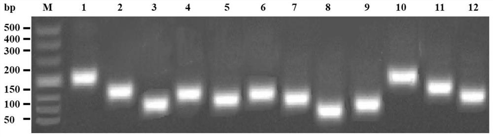 RT-qPCR (Reverse Transcription-Quantitative Polymerase Chain Reaction) detection kit and method for identifying bluetongue virus serotype