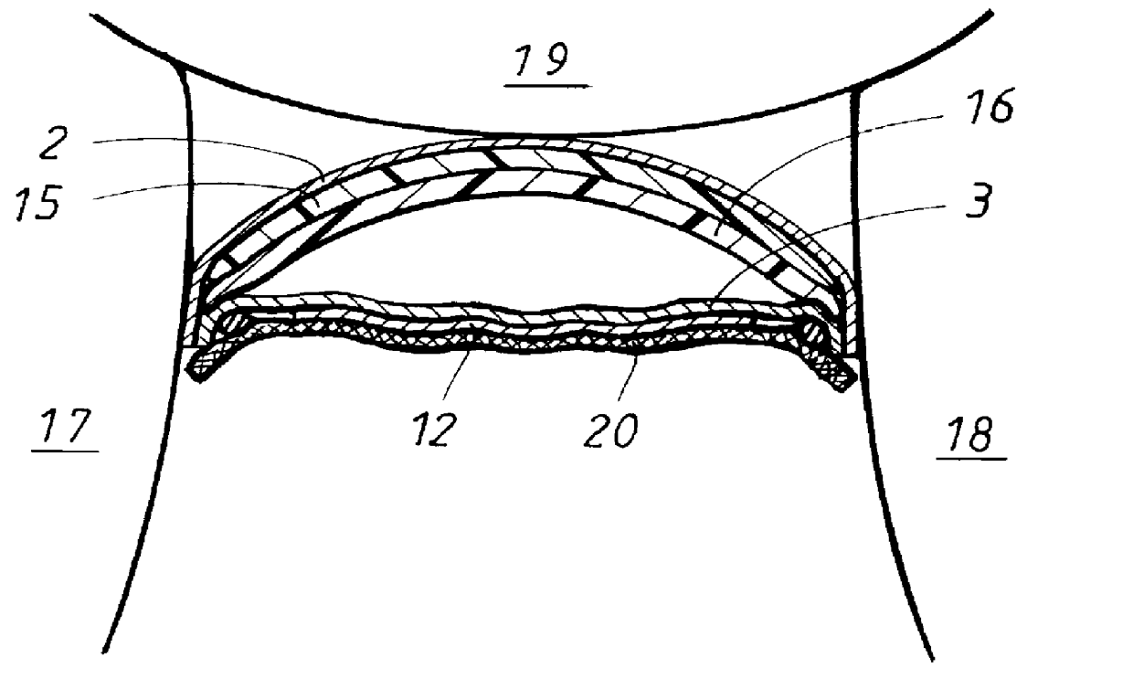 Absorbent article with improved forming ability