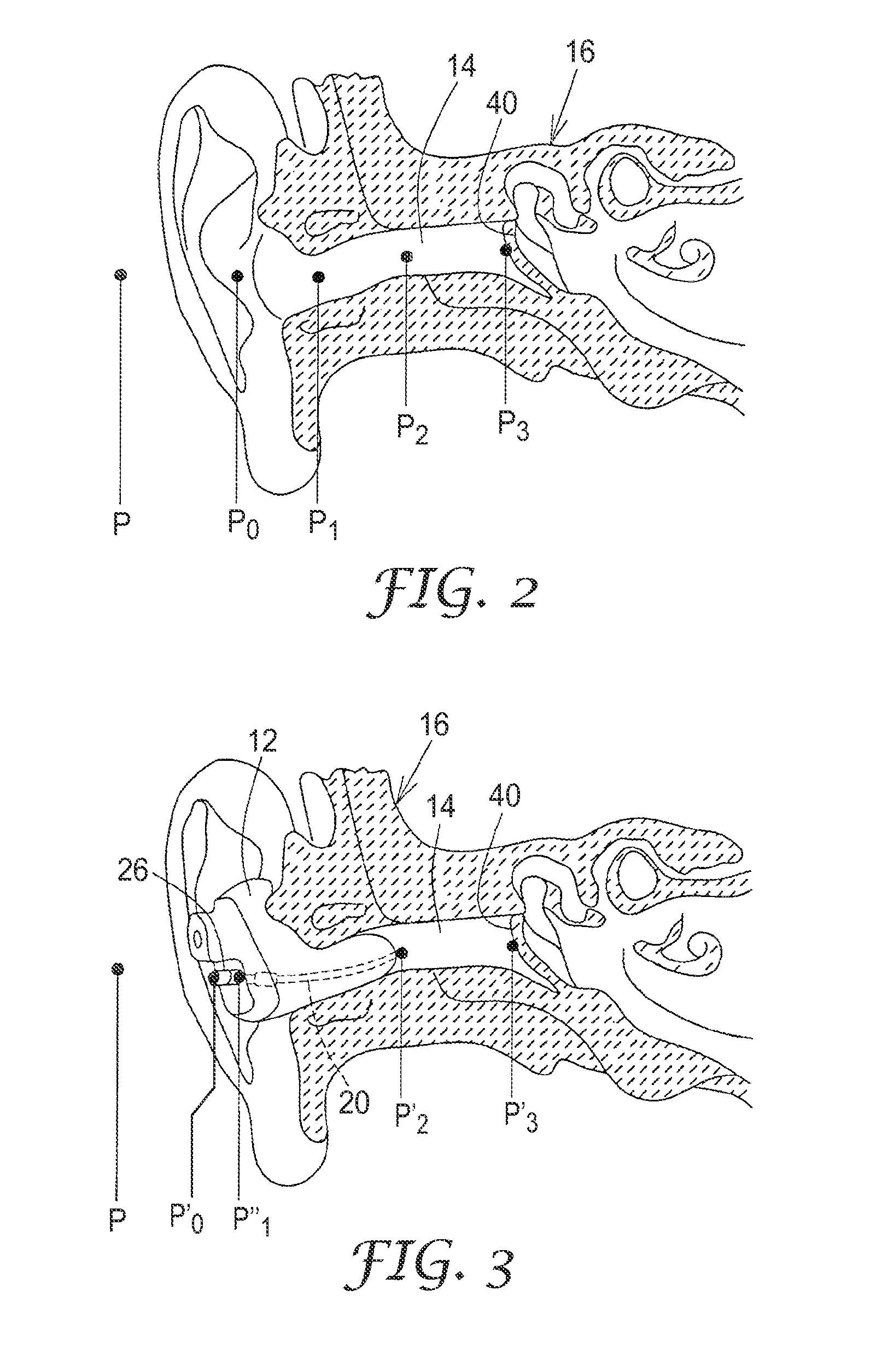 Method and apparatus for objective assessment of in-ear device acoustical performance