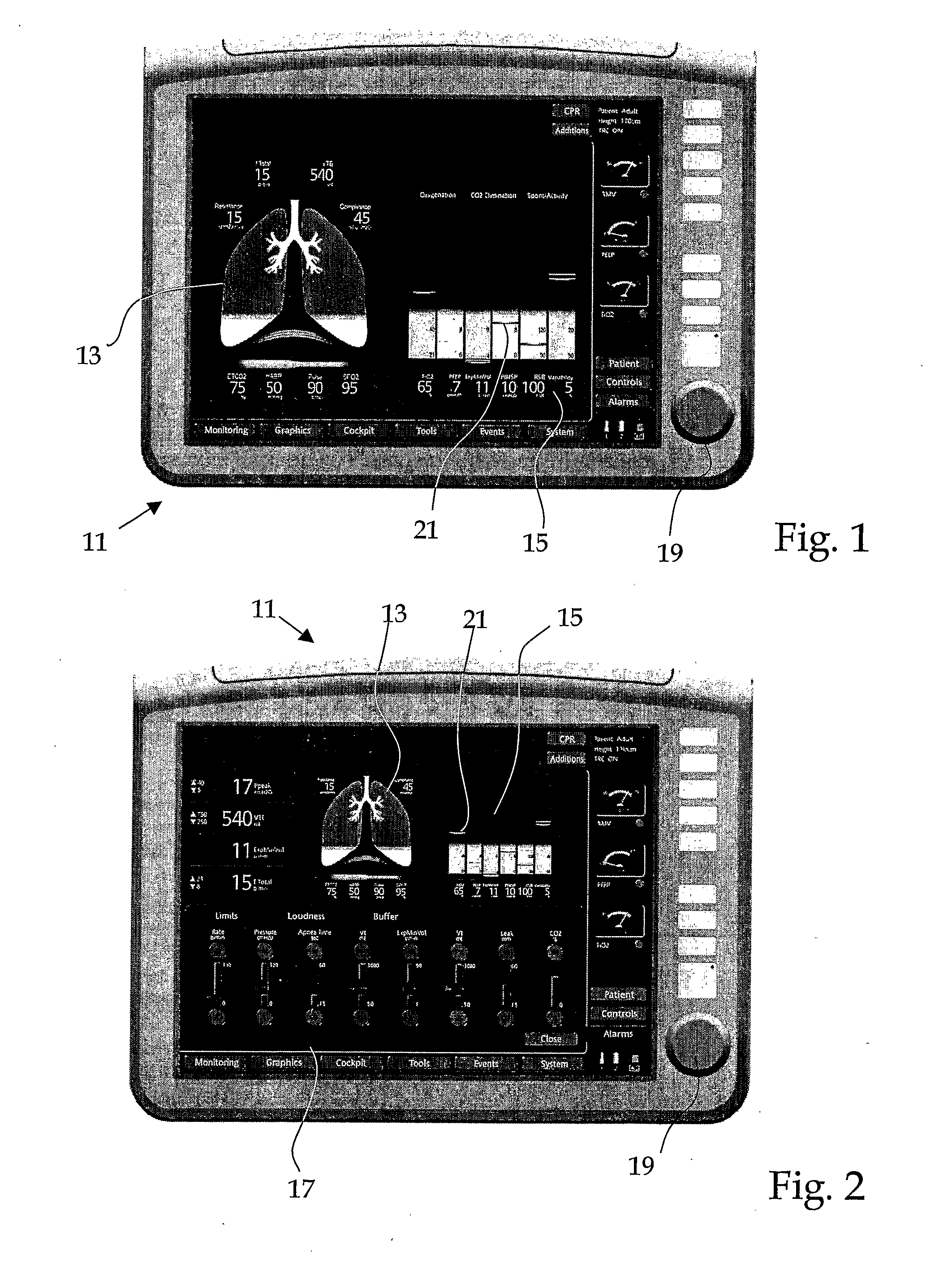 Method and a device for simplifying a diagnostic assessment of a mechanically ventilated patient