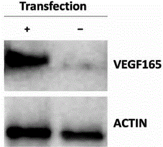 Preparation method of artificial skin by taking VEGF165 gene modified hair follicle stem cells as seed cells