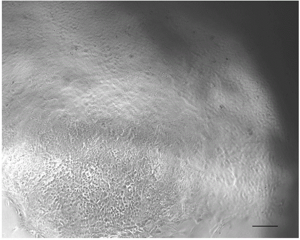 Preparation method of artificial skin by taking VEGF165 gene modified hair follicle stem cells as seed cells