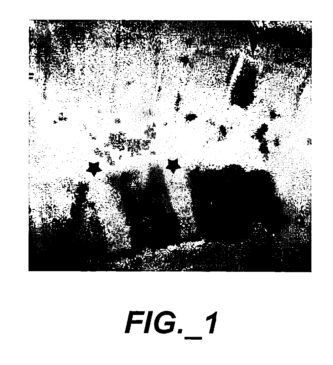 Composition and Method for Preventing Secondary Burn Ischemia