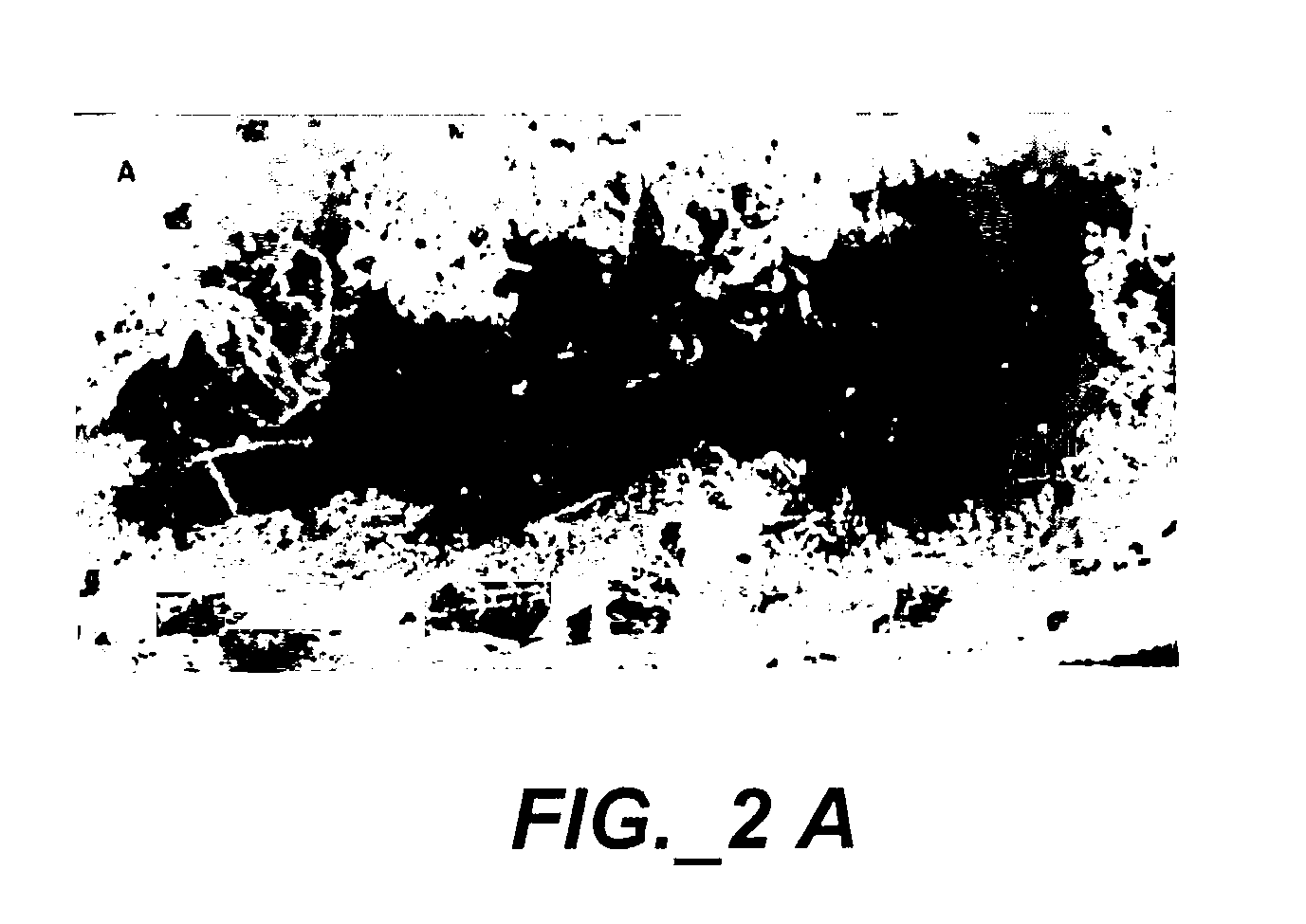 Composition and Method for Preventing Secondary Burn Ischemia