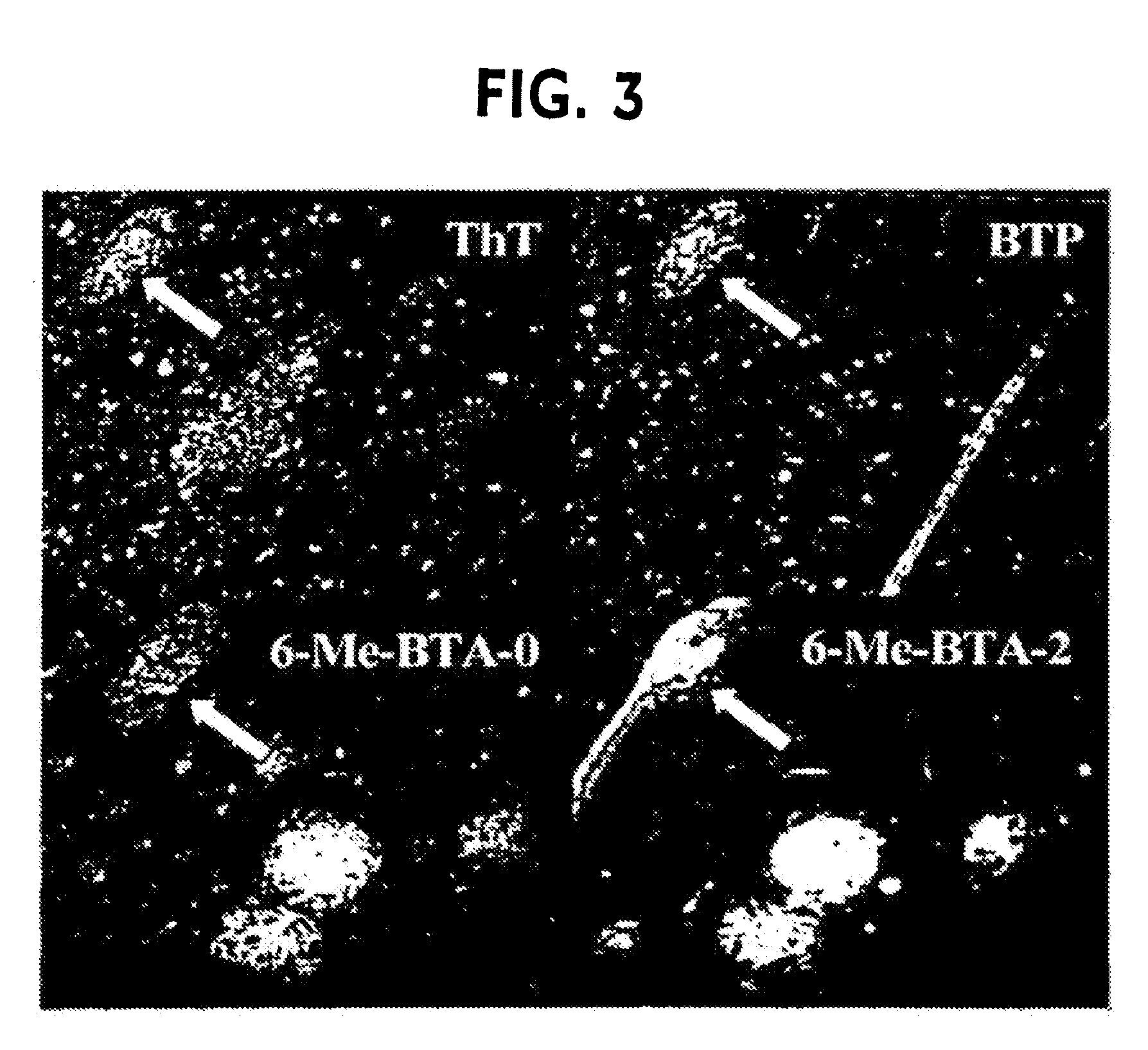 Thioflavin derivatives for use in the antemortem diagnosis of alzheimers disease and in vivo imaging and prevention of amyloid deposition