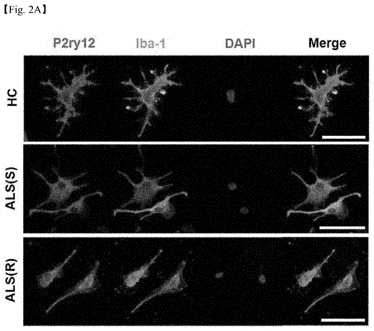 Pharmaceutical composition for preventing or treating neurodegenerative disease comprising nckap1 protein or gene encoding same