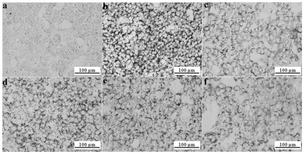Application of ethanol extract of bean taro leaves in reducing lipid deposition in liver cells