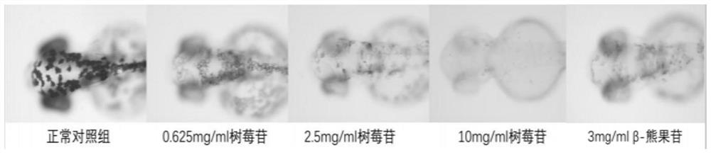Whitening cosmetic composition as well as preparation method and application thereof
