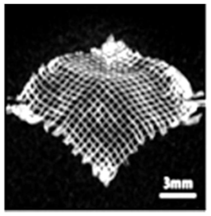 Preparation method of super-bionic soft and hard tissue composite scaffold