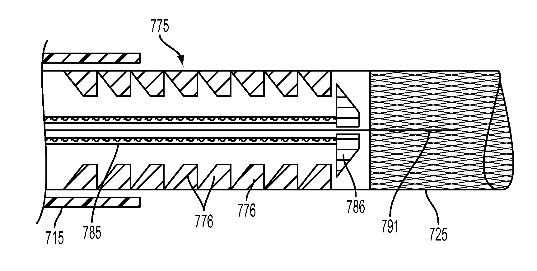 Stent Deployment Device and Methods for Use