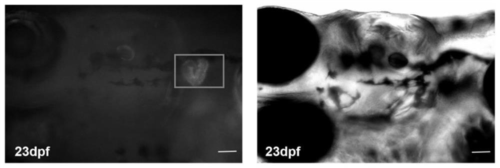 Preparation method and application of transgenic zebra fish capable of specifically removing T cells