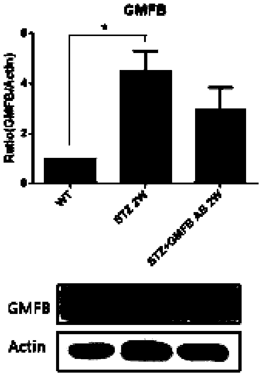 Application of GMFB antibody in preparation of drugs for treating diabetic retinopathy
