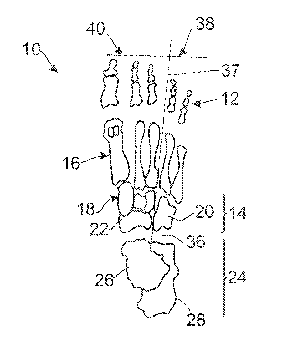 Apparatus for adjusting foot structures, for design of a foot orthotic, and methods of use